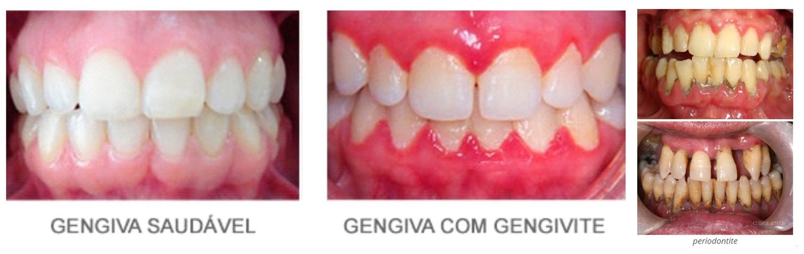 Periodontia Clinica Studio Oral